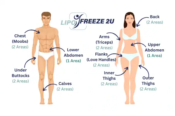 Areas you can have fat freezing treatment Rayleigh