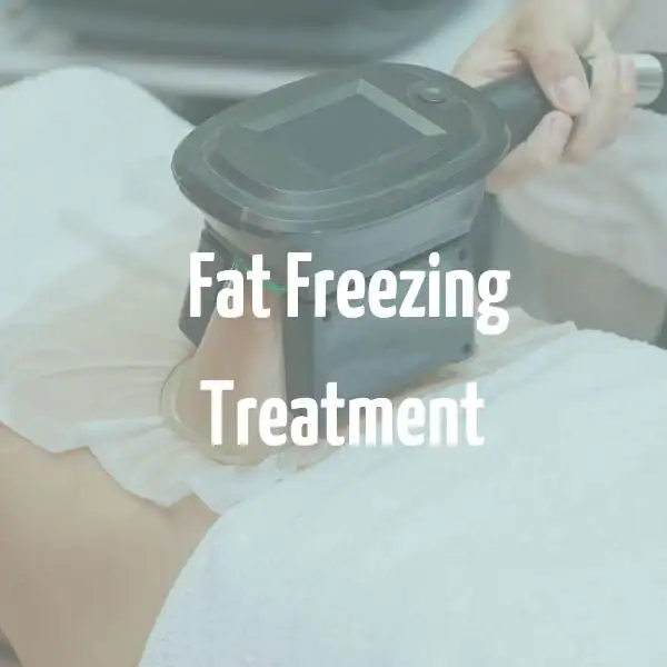 fat freezing treatment Rayleigh