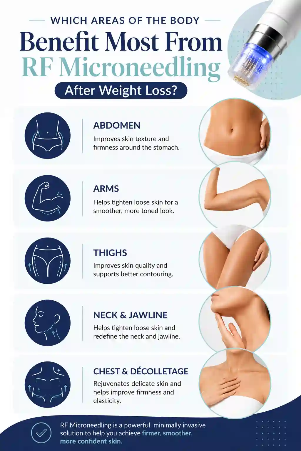 Which Areas of the Body Benefit Most From RF Microneedling After Weight Loss Rayleigh